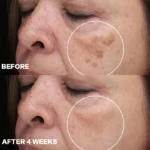 High Quality Korean Face Serum Arbutin Skin Care Products Skin Whitening Brightening Moisturizer Lightening Facial