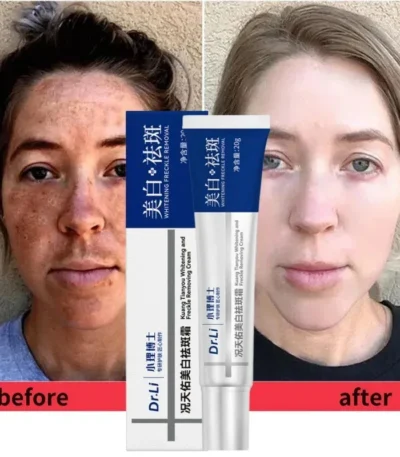 Dr. Li Freckle Whitening Cream Fade Dark Spot Brightening Black Dot Melasma Chloasma Removal Smooth Tender Moisturizer Skin