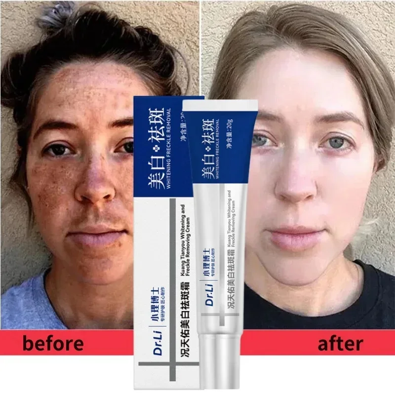 Dr. Li Freckle Whitening Cream Fade Dark Spot Brightening Black Dot Melasma Chloasma Removal Smooth Tender Moisturizer Skin