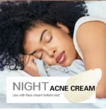 AILKE Natural Turmeric Brightening Face Cream, Glow Boosting, Skin Moisturizer, Anti-Acne Facial Cream, for All Skin Tone