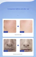 Dr. Li Freckle Whitening Cream Fade Dark Spot Brightening Black Dot Melasma Chloasma Removal Smooth Tender Moisturizer Skin
