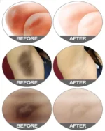 Whitening Cream For Dark Skin Underarm Bleaching Armpit Lightening And Intimate Area Woman Moisturizer Korean Skin Care