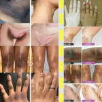 Body Whitening Cream Dark Skin Armpit Lightening Intimate Areas Underarm Bleaching Private Parts Whiten Cream Body Lotion