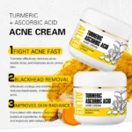 AILKE Natural Turmeric Brightening Face Cream, Glow Boosting, Skin Moisturizer, Anti-Acne Facial Cream, for All Skin Tone