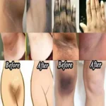Whitening Cream For Dark Skin Underarm Bleaching Armpit Lightening And Intimate Area Woman Moisturizer Korean Skin Care
