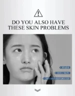 Dr. Li Freckle Whitening Cream Fade Dark Spot Brightening Black Dot Melasma Chloasma Removal Smooth Tender Moisturizer Skin