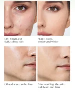 Pore Cleaning Soap Anti-Acne Shrink Pores Deep Remove Blackheads Chicken Skin Oil Control Moisturizer whitening Smooth Skin