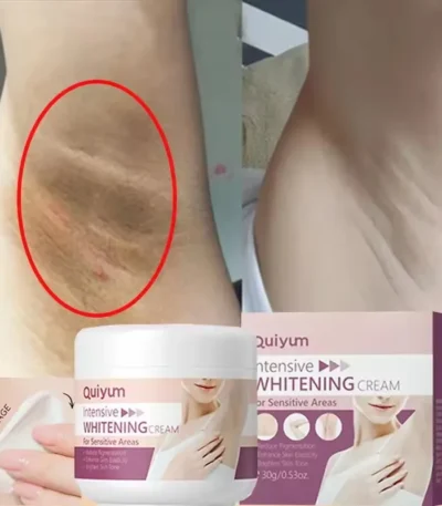 Whitening Cream For Dark Skin Underarm Bleaching Armpit Lightening And Intimate Area Woman Moisturizer Korean Skin Care