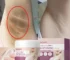 Whitening Cream For Dark Skin Underarm Bleaching Armpit Lightening And Intimate Area Woman Moisturizer Korean Skin Care
