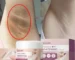 Whitening Cream For Dark Skin Underarm Bleaching Armpit Lightening And Intimate Area Woman Moisturizer Korean Skin Care