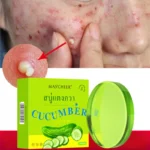 Pore Cleaning Soap Anti-Acne Shrink Pores Deep Remove Blackheads Chicken Skin Oil Control Moisturizer whitening Smooth Skin