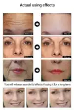 Retinol Remove Wrinkle Face Serum Lift Firming Anti Aging Fade Fine Lines Whitening Brightening Moisturizer Skin Care