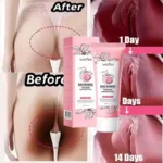 Body Whitening Cream Dark Skin Armpit Lightening Intimate Areas Underarm Bleaching Private Parts Whiten Cream Body Lotion