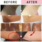 Whitening Cream For Dark Skin Underarm Bleaching Armpit Lightening And Intimate Area Woman Moisturizer Korean Skin Care