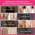 Whitening Cream For Dark Skin Underarm Bleaching Armpit Lightening And Intimate Area Woman Moisturizer Korean Skin Care
