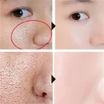 Pore Cleaning Soap Anti-Acne Shrink Pores Deep Remove Blackheads Chicken Skin Oil Control Moisturizer whitening Smooth Skin