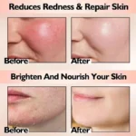Facial redness repair cream being applied to a forearm, blending into skin.