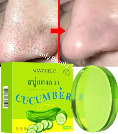 Pore Cleaning Soap Anti-Acne Shrink Pores Deep Remove Blackheads Chicken Skin Oil Control Moisturizer whitening Smooth Skin