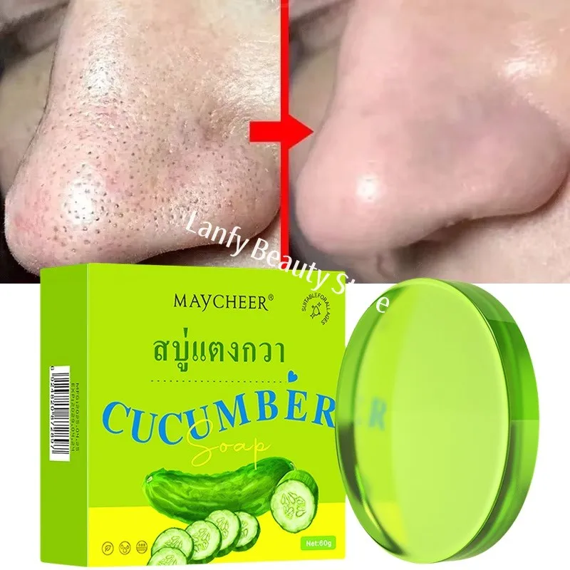 Pore Cleaning Soap Anti-Acne Shrink Pores Deep Remove Blackheads Chicken Skin Oil Control Moisturizer whitening Smooth Skin
