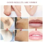 Whitening Cream For Dark Skin Underarm Bleaching Armpit Lightening And Intimate Area Woman Moisturizer Korean Skin Care
