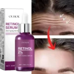 Goldoma Retinol Face Serum in a glass dropper bottle, front view on a white table.