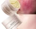 Facial redness repair cream in a white tube with red accents, on a clean bathroom counter.