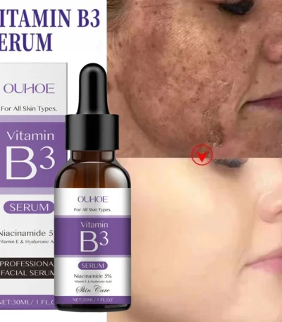 Hoygi Niacinamide Facial Serum bottle on white background, front view with label visible.