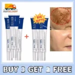 Dr. Li Freckle Whitening Cream Fade Dark Spot Brightening Black Dot Melasma Chloasma Removal Smooth Tender Moisturizer Skin