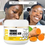AILKE Natural Turmeric Brightening Face Cream, Glow Boosting, Skin Moisturizer, Anti-Acne Facial Cream, for All Skin Tone