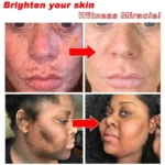 Dr. Li Freckle Whitening Cream Fade Dark Spot Brightening Black Dot Melasma Chloasma Removal Smooth Tender Moisturizer Skin