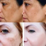 Dr. Li Freckle Whitening Cream Fade Dark Spot Brightening Black Dot Melasma Chloasma Removal Smooth Tender Moisturizer Skin