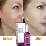 Retinol Remove Wrinkle Face Serum Lift Firming Anti Aging Fade Fine Lines Whitening Brightening Moisturizer Skin Care