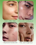 Pore Cleaning Soap Anti-Acne Shrink Pores Deep Remove Blackheads Chicken Skin Oil Control Moisturizer whitening Smooth Skin