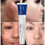 Dr. Li Freckle Whitening Cream Fade Dark Spot Brightening Black Dot Melasma Chloasma Removal Smooth Tender Moisturizer Skin