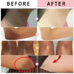 Body Whitening Cream Dark Skin Armpit Lightening Intimate Areas Underarm Bleaching Private Parts Whiten Cream Body Lotion