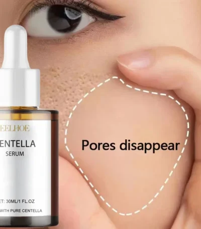Centella Asiatica Face Serum Nourish Dry Skin Smoothing Rejuvenation Skin Brightening Whitening Cream Facial Moisturizer
