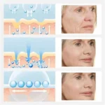 Retinol Remove Wrinkle Face Serum Lift Firming Anti Aging Fade Fine Lines Whitening Brightening Moisturizer Skin Care