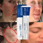 Dr. Li Freckle Whitening Cream Fade Dark Spot Brightening Black Dot Melasma Chloasma Removal Smooth Tender Moisturizer Skin