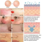 Before application: red cheeks and spider veins visible on a face model.
