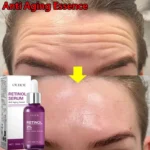 Retinol Remove Wrinkle Face Serum Lift Firming Anti Aging Fade Fine Lines Whitening Brightening Moisturizer Skin Care