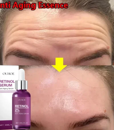Retinol Remove Wrinkle Face Serum Lift Firming Anti Aging Fade Fine Lines Whitening Brightening Moisturizer Skin Care